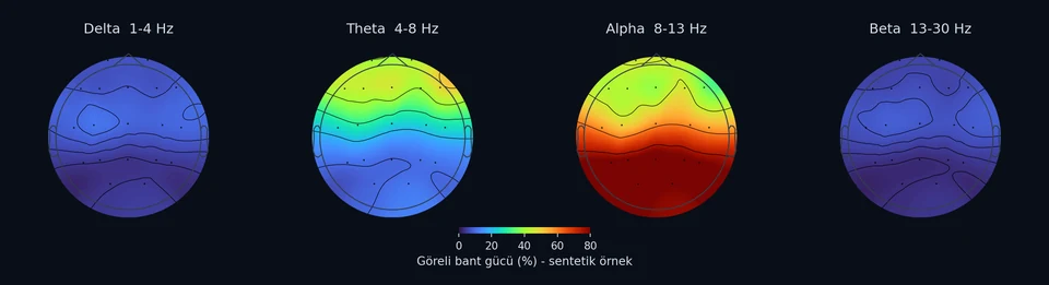 Sentetik EEG’den hesaplanan delta, theta, alfa ve beta bantlarında göreli güç dağılımı. Renkler yüzde ölçeğini gösterir; normal/anormal veya iyileşme sonucu değildir.